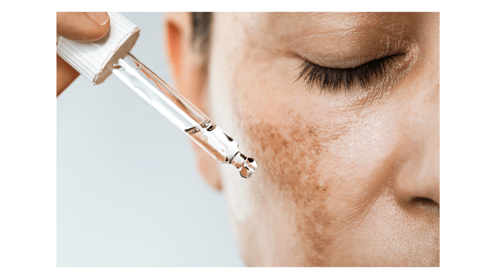 Unlocking The Secrets: Exploring The Factors Behind Skin Hyperpigmentation